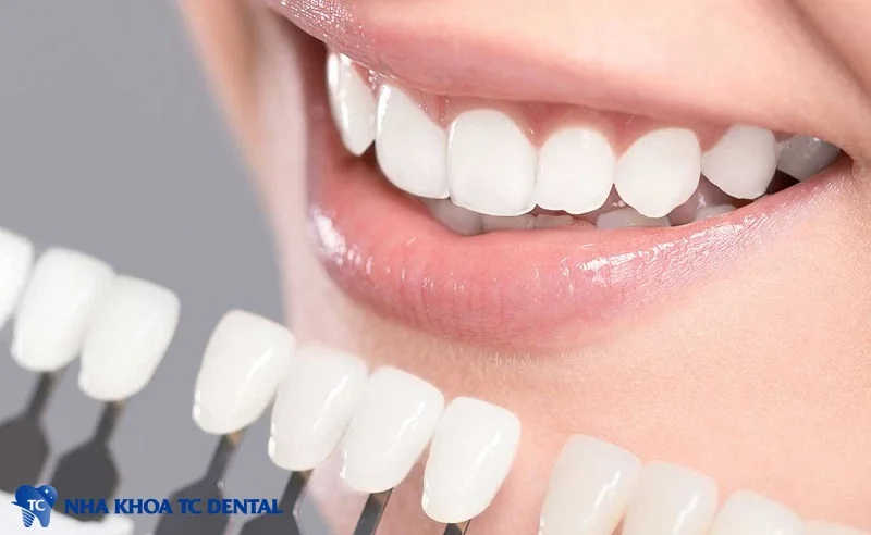 Răng sứ HT Smile có chất liệu sứ an toàn giúp bảo vệ tối đa cấu trúc răng thật