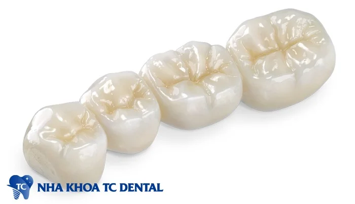  Răng sứ zirconia nguyên khối phù hợp để phục hồi răng hàm 