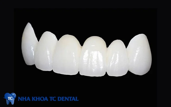 Răng sứ Zirconia HT có độ trong mờ cao hơn