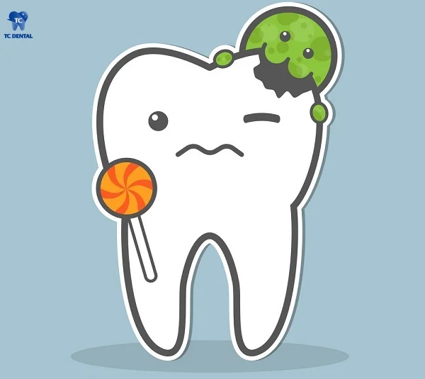 Chế độ ăn uống nhiều đường dễ gây sâu răng